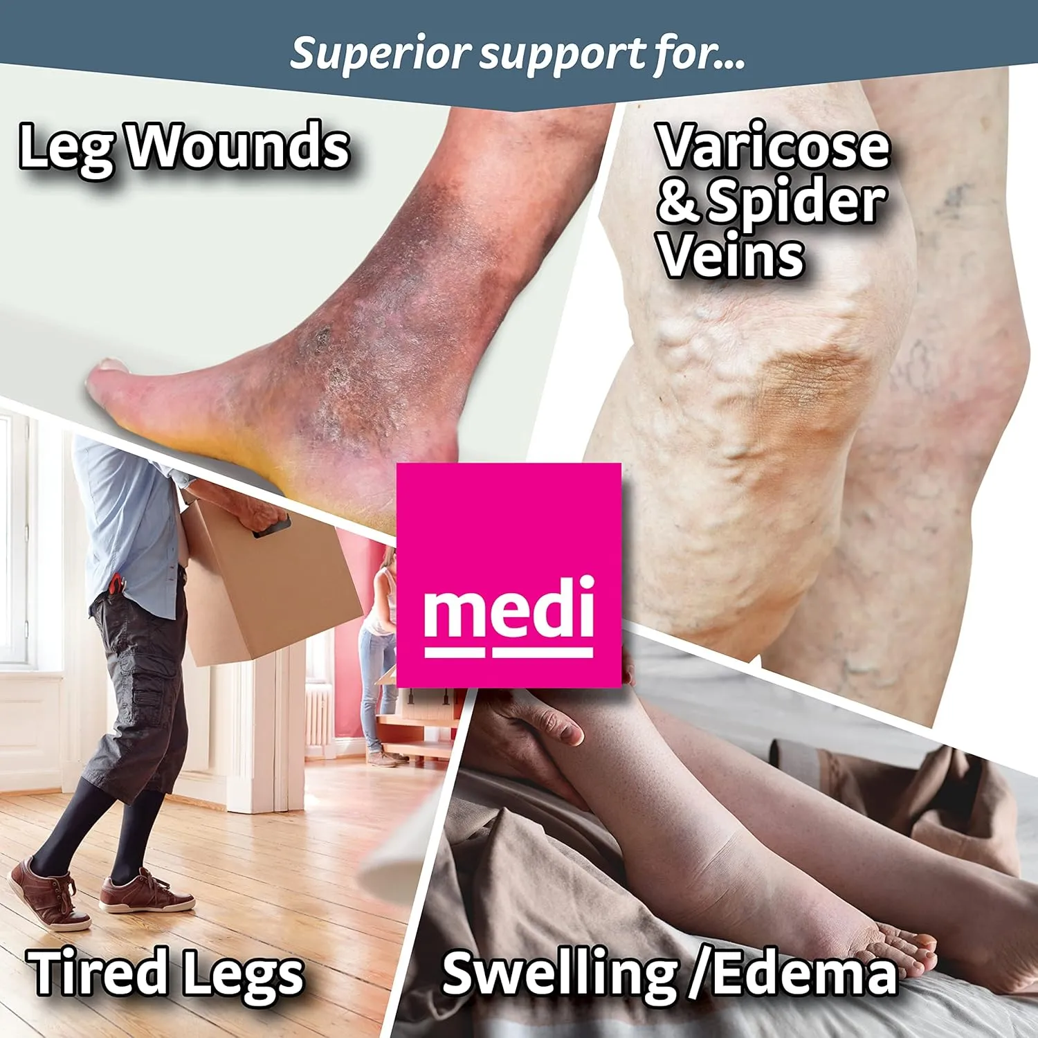 mediven Plus for Men & Women, 30-40 mmHg – Open Toe, Knee High Compression Socks with Silicone Top Band